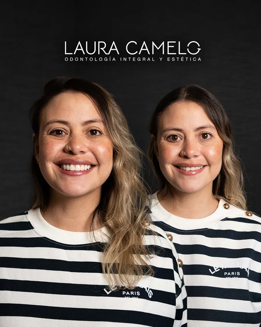 Carillas dentales porcelana — caso clínico exitoso